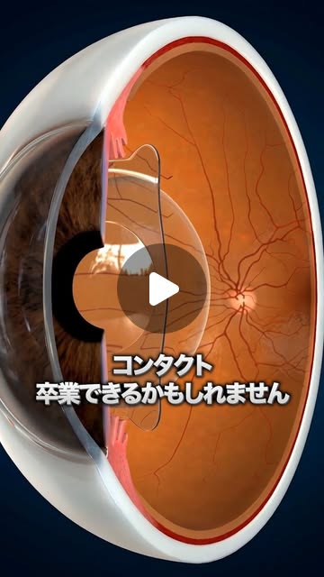 Instagram reel